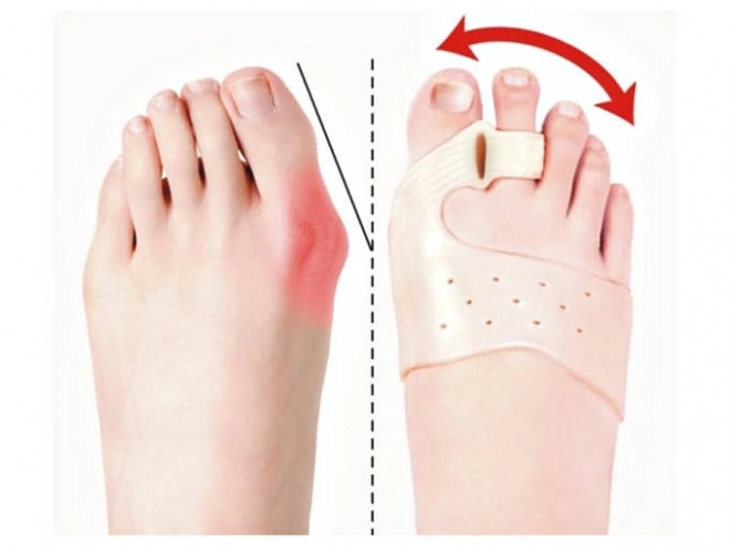 Tå adskiller for hallux valgus med magnet